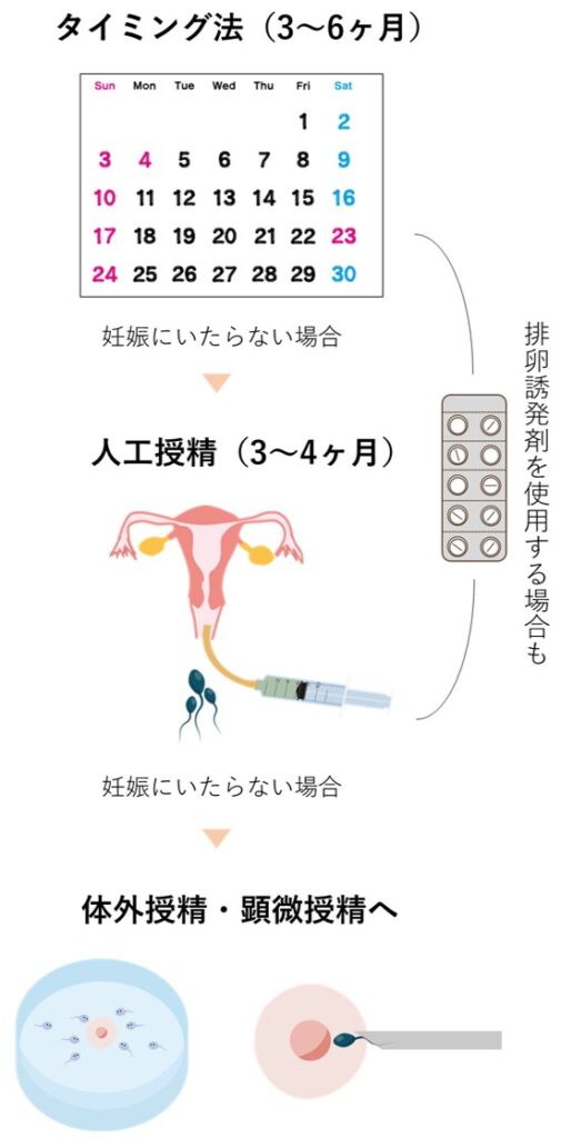 不妊治療のステップ